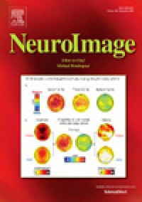 Neuroimage